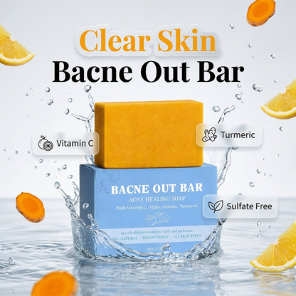Body Acne Soap for Clearer Skin